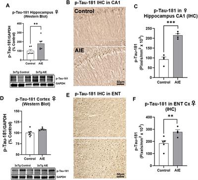 Adolescent Binge Alcohol Enhances Early Alzheimer’s Disease Pathology in Adulthood Through Proinflammatory Neuroimmune Activation